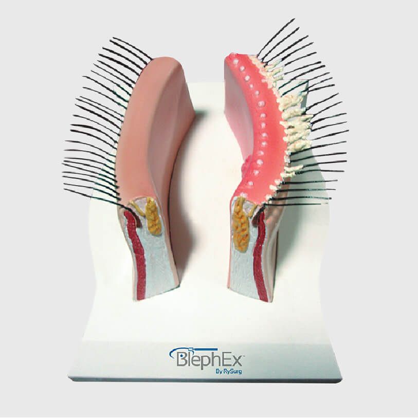 deep eyelid cleabing