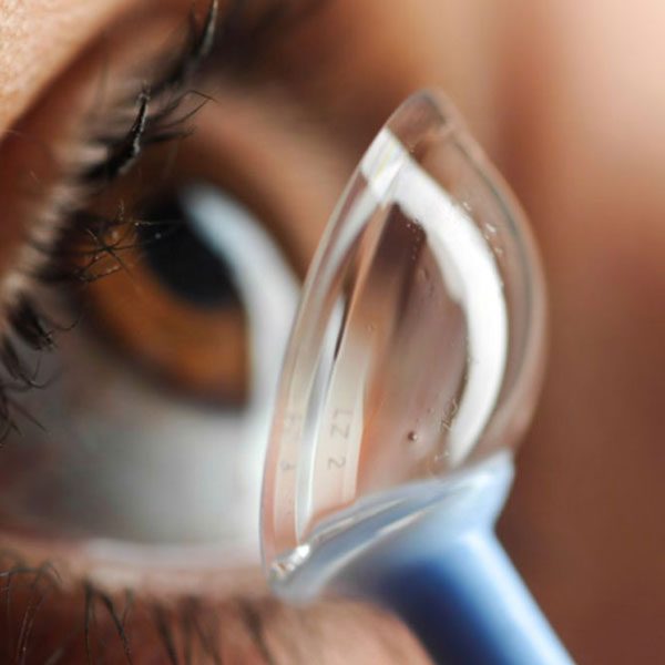 scleral lenses